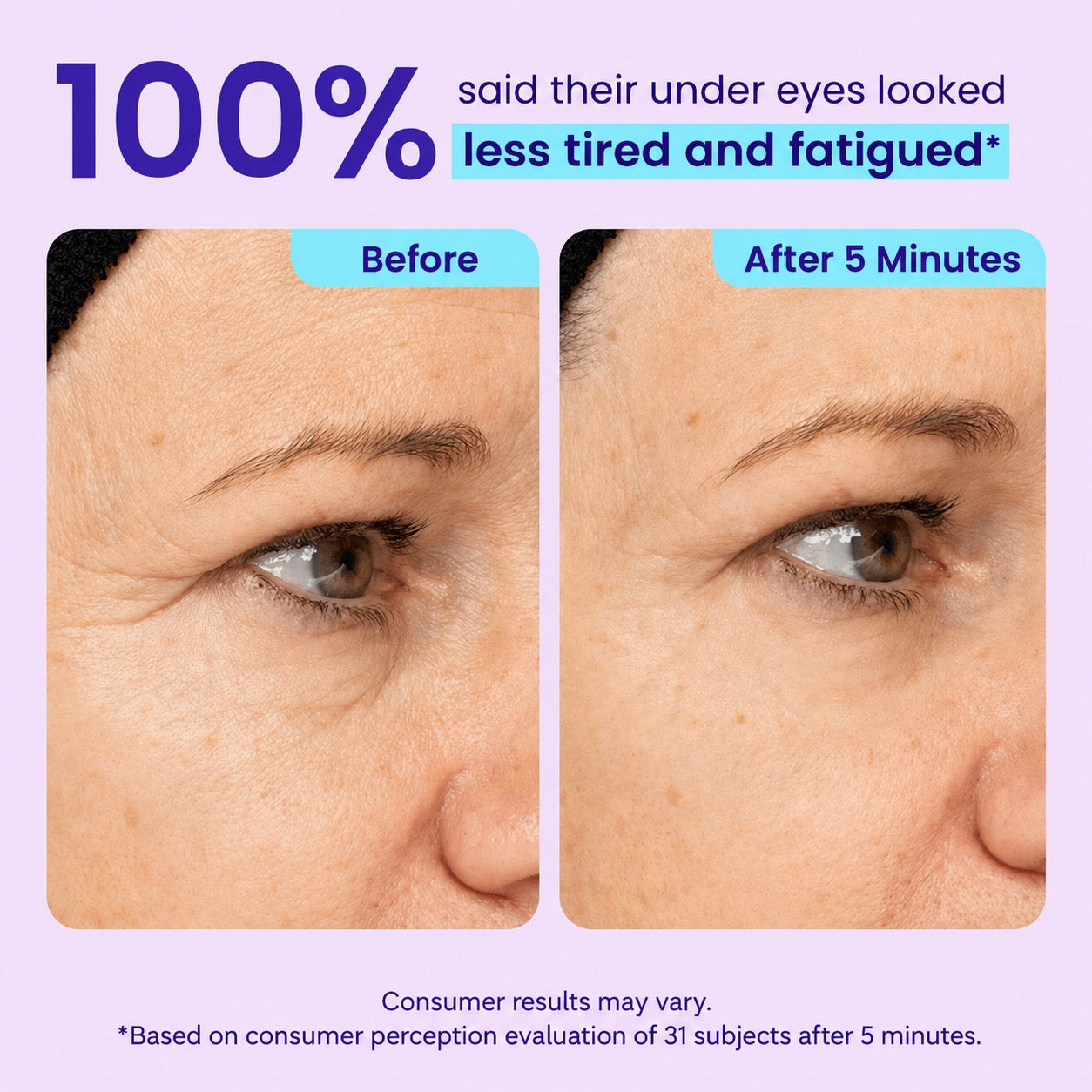 Instant Lift Eye Gel